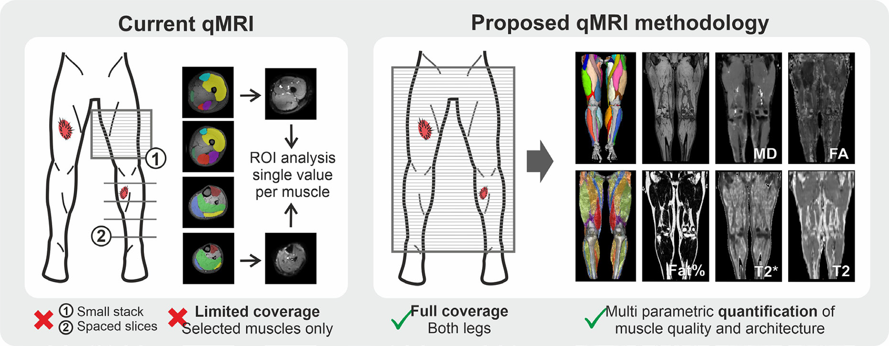 Bilateral acquisition of quantitative muscle MRI data of the whole leg